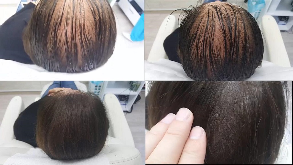 重庆纹发高精密纹发