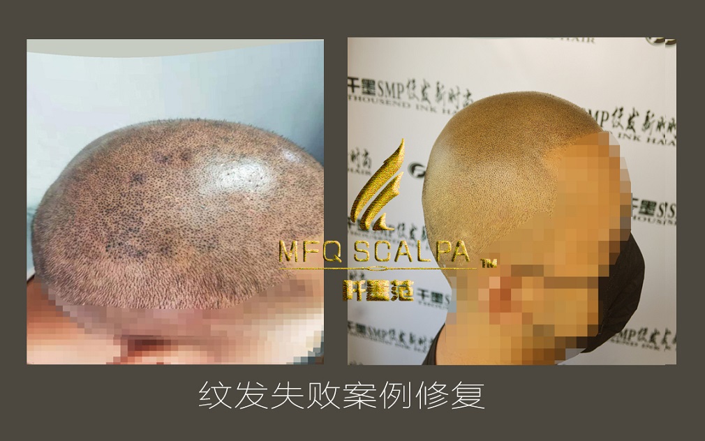 COVER 纹发失败修复
