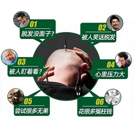 阡墨范妙招：脱发的调理缓解