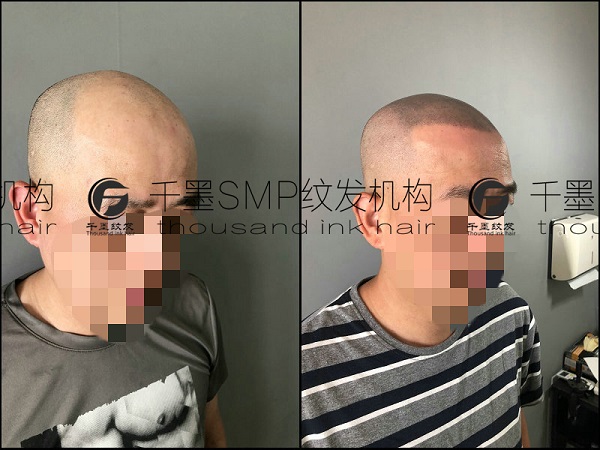 对纹发效果质疑？重庆纹发阡墨范简析