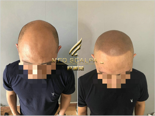 小王赴重庆纹发记录形象转变记