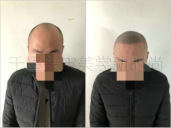 你是否庆幸选择了对的重庆纹发机构？