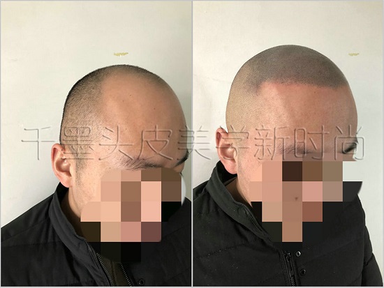 你是否庆幸选择了对的重庆纹发机构？