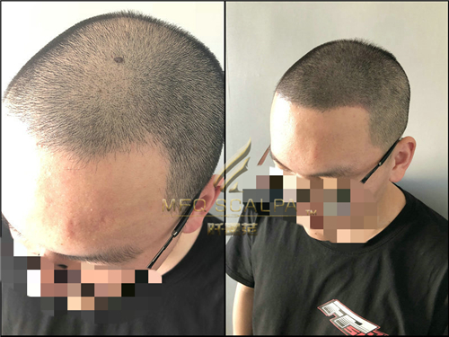 信赖和口碑，是重庆纹发机构拓展的支撑