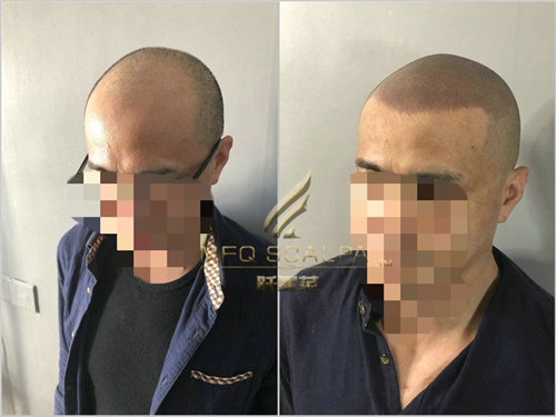 重庆纹发最早、最成熟、最专业、正规、技术最好的纹发机构是哪家？