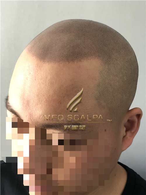 选择纹发行业作为事业，是发友的双赢