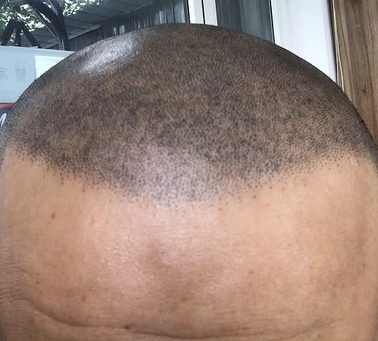 纹发失败案例分析