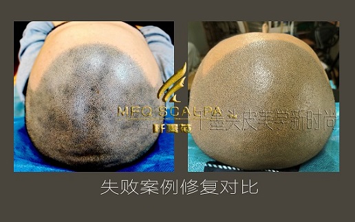 纹发的误区：纹发不是越黑越好