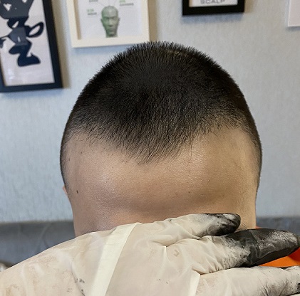 宁愿秃头也要变强？纹发让你锦上添花