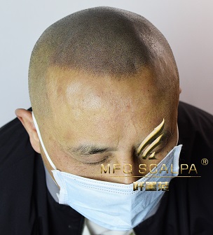 纹发几小时，形象逆袭不是梦