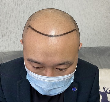 重庆纹发阡墨范的发友纹发前