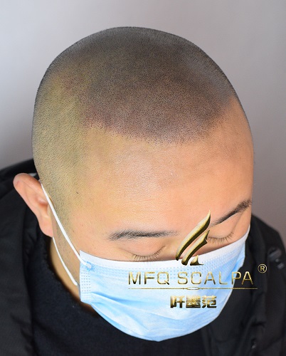 重庆纹发阡墨范的纹发效前后果对比