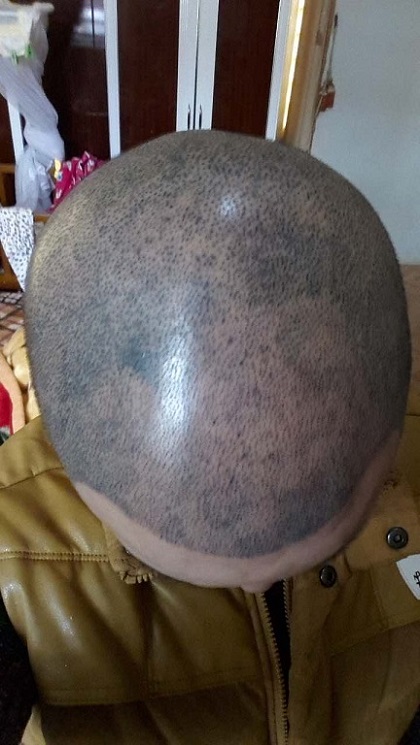 如何补救解决纹发晕色的技术问题