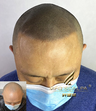 高品质纹发技术的魅力，近距离也难能辨别真假