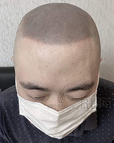 选择纹发技术迫在眉睫，让你清凉一夏