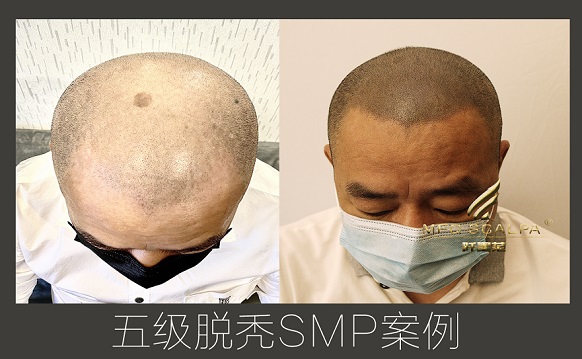 选择到重庆纹发，还更待何时？