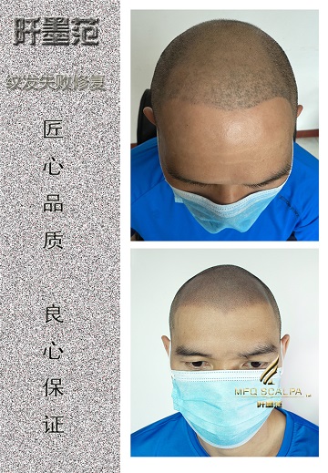 重庆纹发阡墨范，邀请体验视觉无痕3D纹发