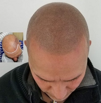 重庆纹发效果的好坏，关键在于纹发师细微拿捏处理的精度