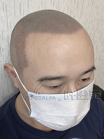 重庆纹发被越来越多的发友称赞和推崇