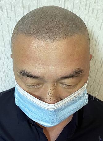 选择纹发机构犯难？重庆纹发纹发需慎重，谨防掉坑