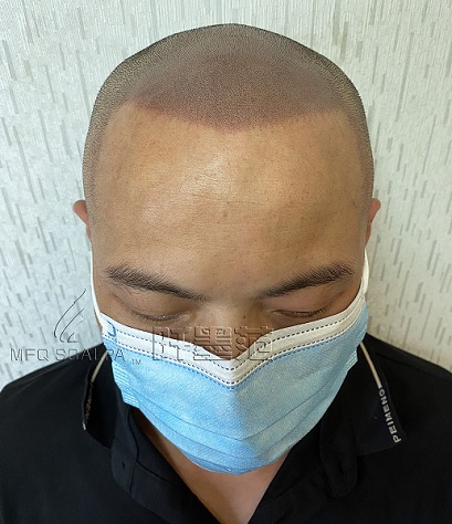 重庆纹发揭露“绅士”帽背后的秘密