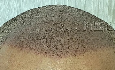 纹发效果如何才是好？怎样才能做到栩栩如生的？