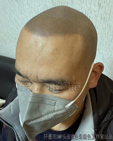 重庆纹发谈关于为什么说纹发效果不好、谈“纹”色变