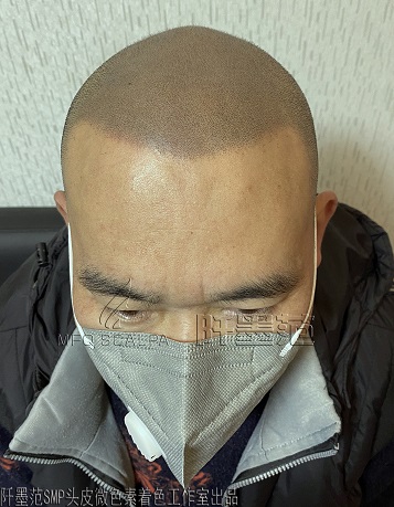 纹发会掉毛囊！谁在危言耸听？
