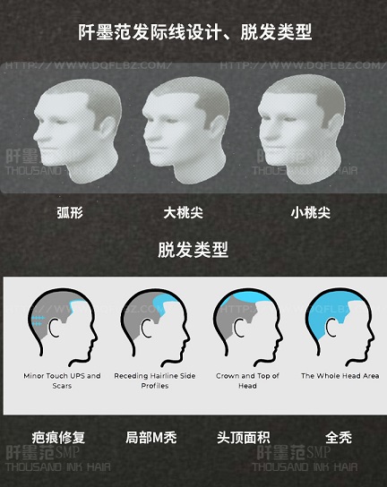 作为重庆SMP纹发的开创机构，我们有责任提供高品质的SMP技术方案