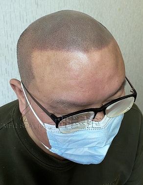 其实脱发也跟发友从事的行业无不关系