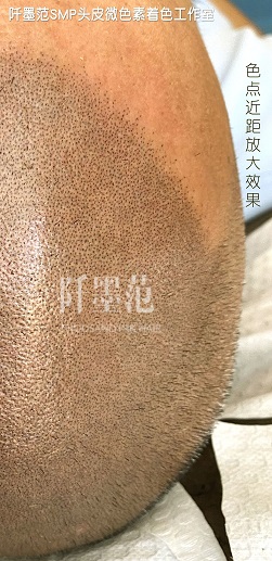 重庆纹发不需要复杂的后期维护就能解决脱发难题