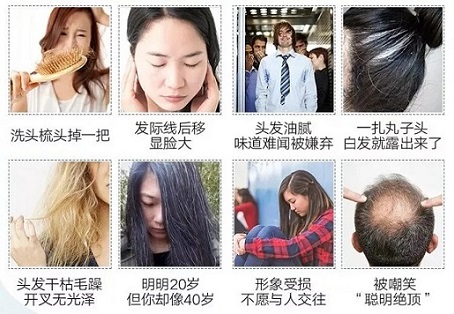 头发的重要性体现在哪些方面？