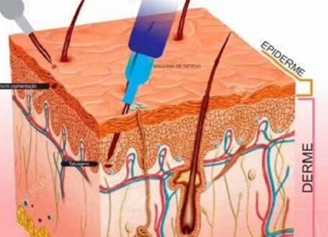 促使头发"跳跃式"生长，3D打印生发真的能阻断脱发？