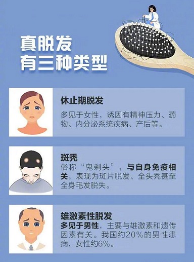 治疗脱发的第一步是了解其病因