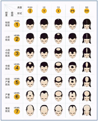 秋季，发友们会恐慌脱发是不是一直持续脱下去，直到寸草不生