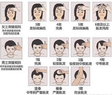 夏季脱发的原因主要包括哪些方面呢？