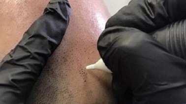 想永远摘下帽子，轻装上阵，选择重庆纹发就能让你梦想成真
