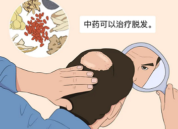 中医的方法就是按顺序、次第治疗脱发