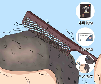 雄激素性脱发，通常从青春期开始，一直持续到40岁左右