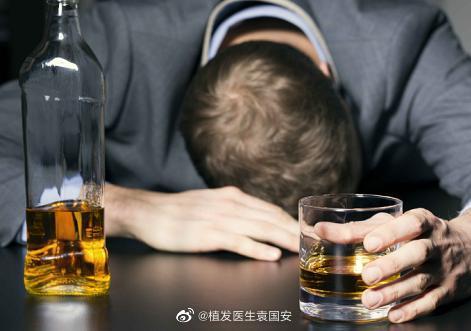 饮酒是否会影响或加剧脱发？