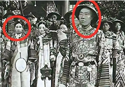 慈禧太后的脱发被李莲英治好了