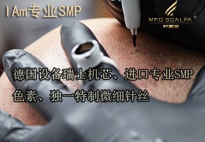 重庆纹发技术改变了人们对传统脱发改善方法的看法