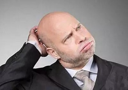 脱发对职场和社交的影响可能超出许多人的预期