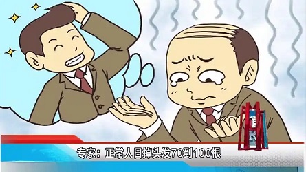 脱发的危害性因个体差异、脱发类型及进展速度而异