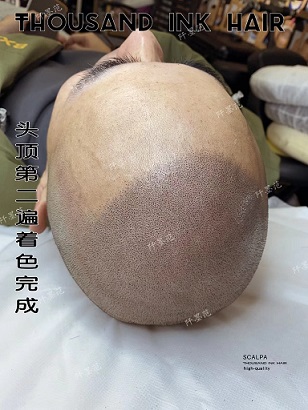重庆纹发对个人生活产生显著影响