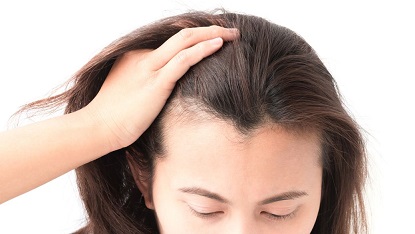 脱发年轻化最科学的解释
