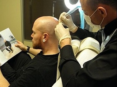 为何说重庆纹发是脱发人最后一根稻草? 为何说重庆纹发是脱发人最后一根稻草?