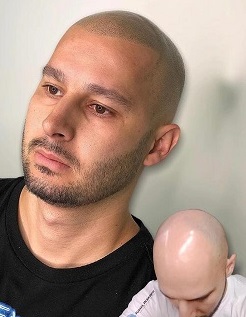 重庆纹发色点的稳定通常需要多久? 重庆纹发色点的稳定通常需要多久?