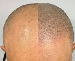 重庆纹发对人们的生活有着多维度的影响 重庆纹发对人们的生活有着多维度的影响