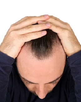 人没有头发,会有多方面影响 人没有头发,会有多方面影响